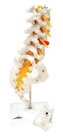 Bone Model-Human Lumbar Spinal Column Model with Dorso-Lateral Prolapsed Intervertebral Disc-3B-Size(CM): 32x12x12