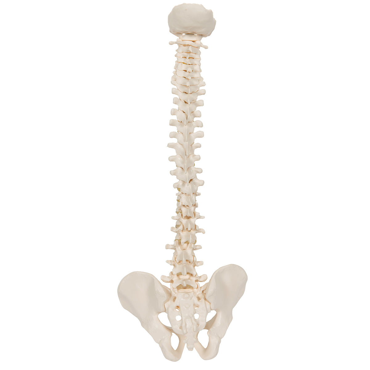 Bone Model-Human Lumbar Spinal Column with Prolapsed Intervertebral Disc-3B-Size(CM): 35x13x6