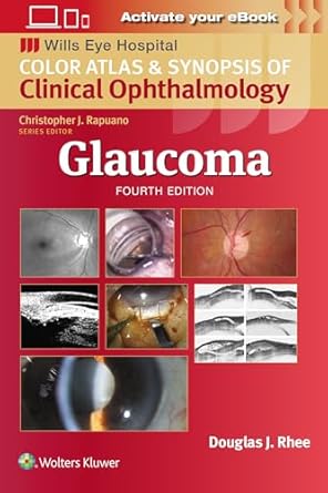 Glaucoma: Wills Eye Institute Atlas Series, 4e