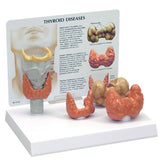 Endocrine Model-Anatomical Thyroid Gland-Ningbo (CM):21x16x18