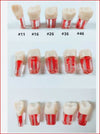 Pre-clinic-Acrylic Teeth with a canal #44