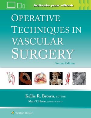 Operative Techniques in Vascular Surgery: Print + eBook with Multimedia, 2e