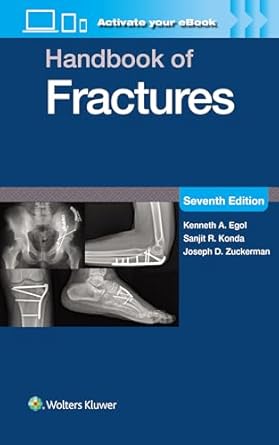Handbook of Fractures: Print + eBook with Multimedia, 7e