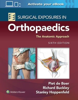 Surgical Exposures in Orthopaedics: The Anatomic Approach, 6e