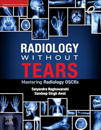 Radiology Without Tears: Mastering Radiology OSCEs | Satyendra Raghuwanshi