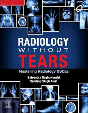 Radiology Without Tears: Mastering Radiology OSCEs