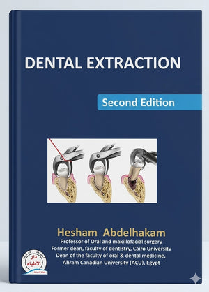 Dental Extraction, 2e