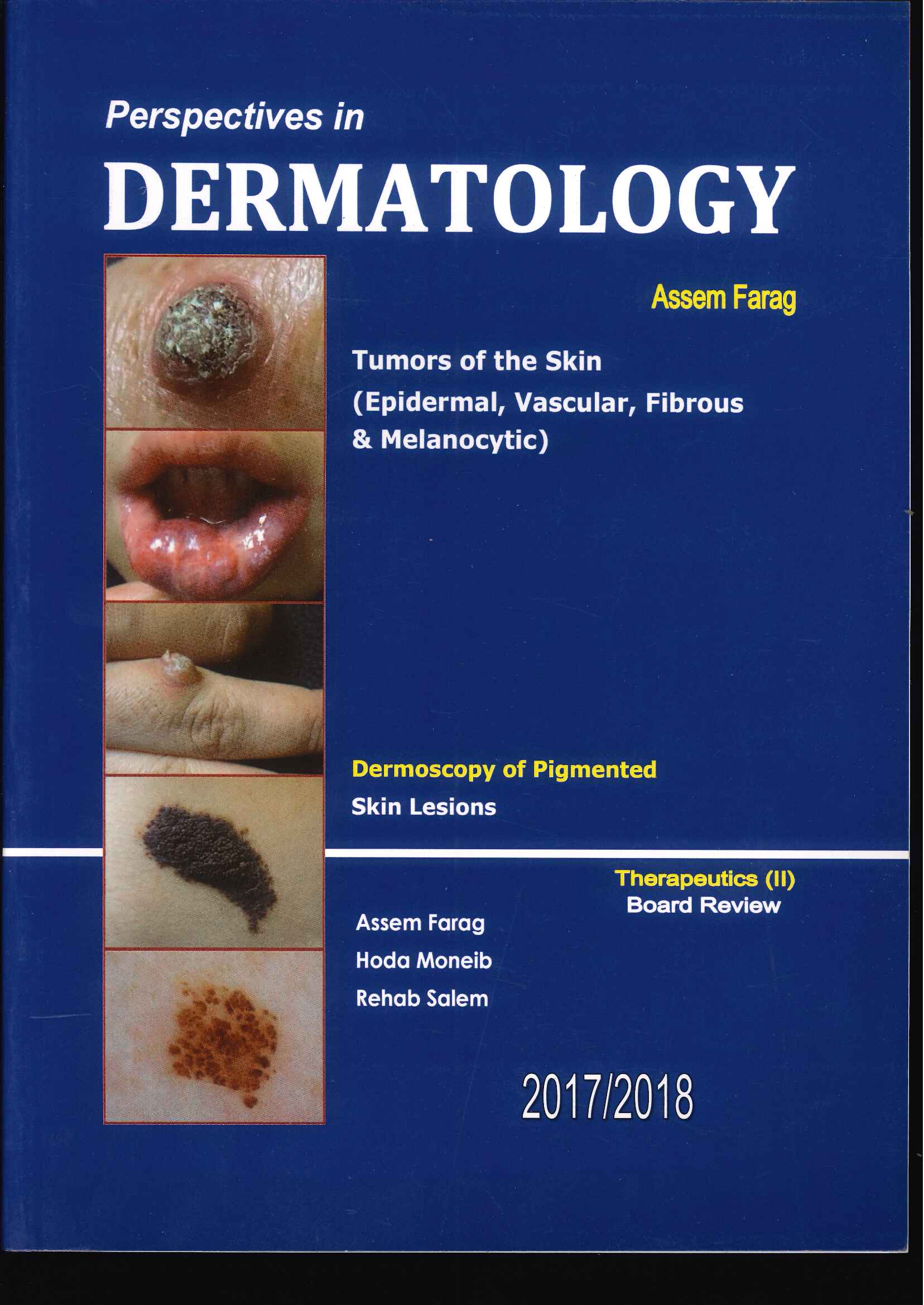 Perspectives in Dermatology: Tumors Of The Skin ( Epidermal, Vascular, Fibrous & Melanocytic) | Assem Farag Perspectives in Dermatology: Tumors Of The Skin ( Epidermal, Vascular, Fibrous & Melanocytic) | Assem Farag