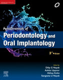 Fundamentals of Periodontology and Oral Implantology, 3e