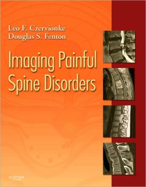 Imaging Painful Spine Disorders**