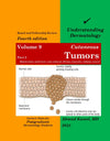 Understanding Dermatology Volume 9: Part 2-Cutaneous Tumors, Mastocytosis, Epidermal, Cysts, Adnexal, Fibrous, Muscular, Adipose, Neural, 4e