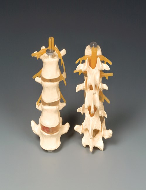 Bone Model-Budget Four-Part Lumbar-Anatomical-Size(CM): 16x9x8