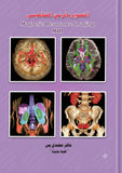 التصوير بالرنين المغناطيسي- Magnetic Resonance Imaging (MRI)