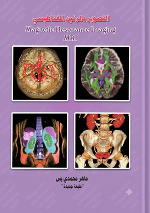 التصوير بالرنين المغناطيسي- Magnetic Resonance Imaging (MRI)