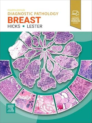 Diagnostic Pathology: Breast, 4e