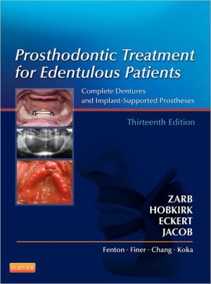 Prosthodontic Treatment for Edentulous Patients, 13e
