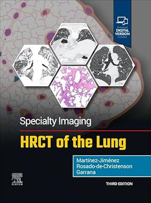 Specialty Imaging: HRCT of the Lung, 3e