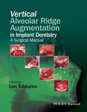 Vertical Alveolar Ridge Augmentation in Implant Dentistry - A Surgical Manual