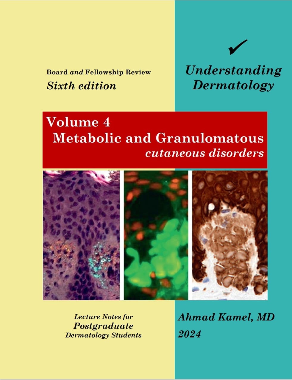 Understanding Dermatology Volume 4: Metabolic and Granulomatous Cutaneous Disorders, 6e Understanding Dermatology Volume 4: Metabolic and Granulomatous Cutaneous Disorders, 6e