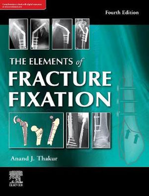 The Elements of Fracture Fixation, 4e | ABC Books