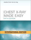 Chest X-Ray Made Easy (IE), 5e