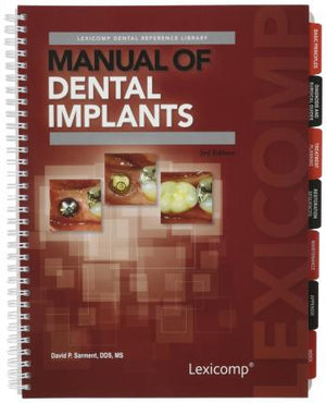 Manual of Dental Implants, 3e