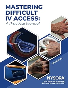 Mastering Difficult IV Access: A Practical Manual