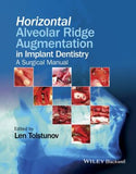 Horizontal Alveolar Ridge Augmentation in Implant Dentistry: A Surgical Manual