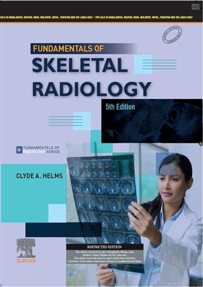 Fundamentals of Skeletal Radiology, South Asia Edition, 5e
