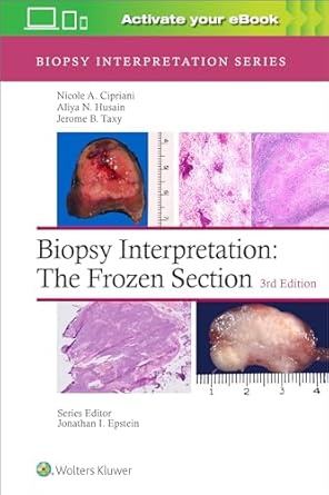 Biopsy Interpretation: The Frozen Section: Print + eBook with Multimedia, 3e