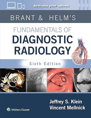Brant & Helm's Fundamentals of Diagnostic Radiology: Print + eBook with Multimedia, 6e