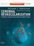 Cerebral Revascularization **