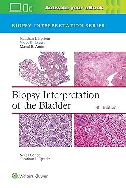 Biopsy Interpretation of the Bladder (Biopsy Interpretation Series), 4e