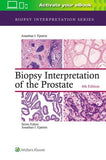 Biopsy Interpretation of the Prostate, 6e