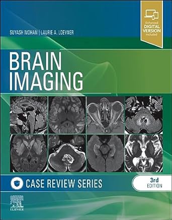 Brain Imaging: Case Review Series, 3e | Suyash Mohan