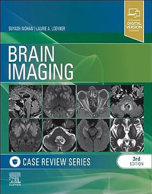 Brain Imaging: Case Review Series, 3e