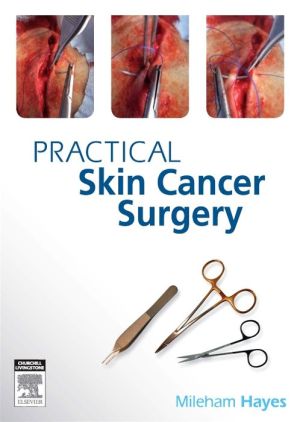 Practical Skin Cancer Surgery