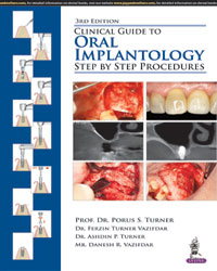 Clinical Guide to Oral Implantology: Step by Step Procedures 3/e