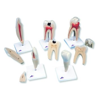 Dentistry Model-Human Tooth Models Set-Classic Series-5 Models-3B(CM):29