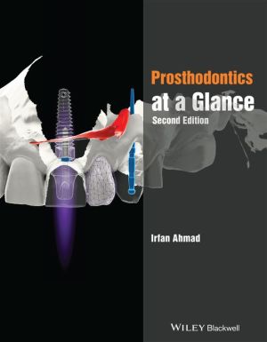 Prosthodontics at a Glance, 2e