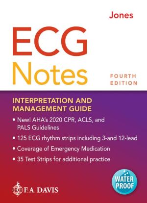 ECG Notes: Interpretation and Management Guide (Davis' Notes), 4e