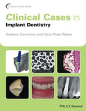 Clinical Cases in Implant Dentistry