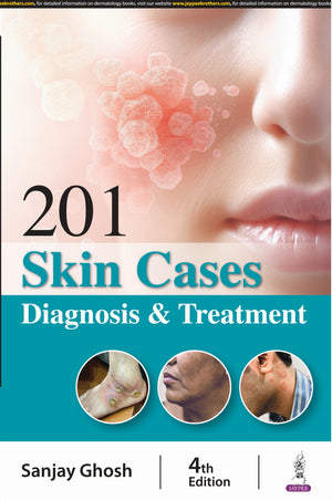 201 Skin Cases Diagnosis & Treatment, 4e