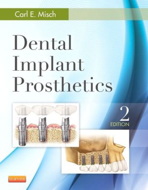 Dental Implant Prosthetics, 2e