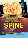 Diagnostic Imaging: Spine, 5e