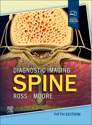 Diagnostic Imaging: Spine, 5e