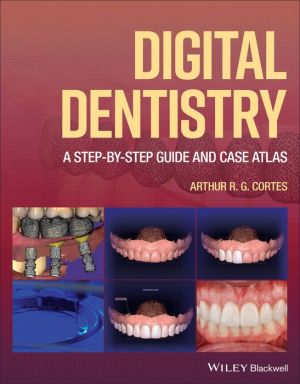 Digital Dentistry: A Step-by-Step Guide and Case Atlas