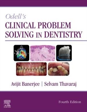 Odell's Clinical Problem Solving in Dentistry, 4e