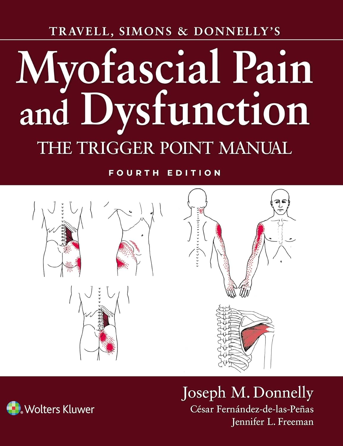 Travell, Simons & Donnelly's Myofascial Pain and Dysfunction: The Trigger Point Manual, 4e | Joseph M. Donnelly