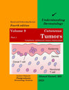 Understanding Dermatology Volume 9: Part 1-Cutaneous Tumors, Lymphoma, Melanocytic Tumors, Histiocytosis, Mastocytosis, 4e